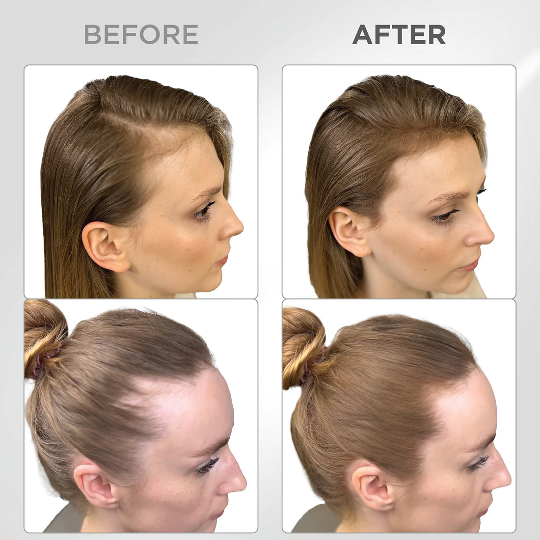 Root Touch Up Powder - Image 9